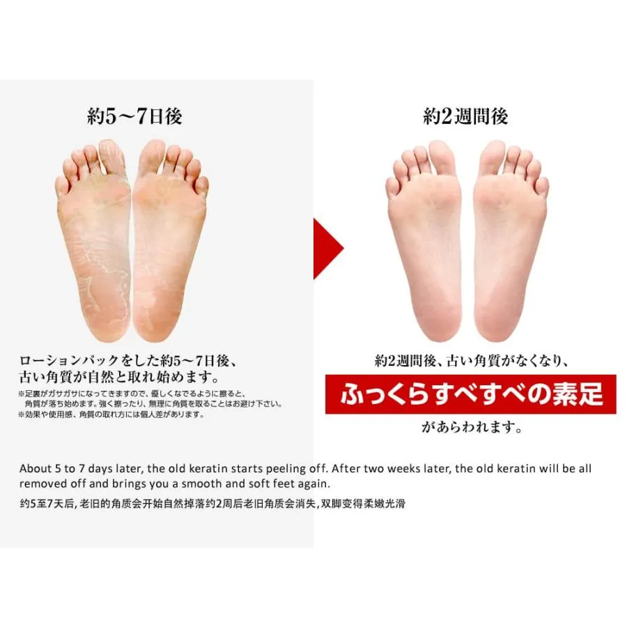 Ashiura Ran Run Foot Peeling Mask 1 pair